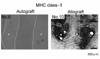  Mikroglia