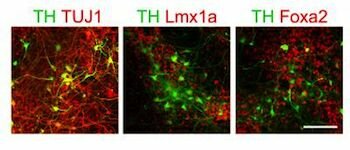  dopaminergen Neuronen