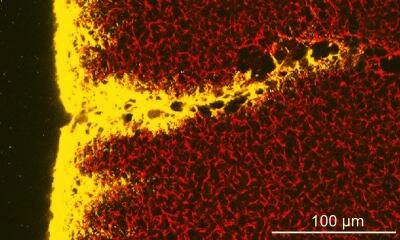  Fluoreszenz-Imaging eines Clot Netzwerk