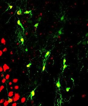  Gehirn- Repair nach der Verletzung und der Alzheimer-Krankheit