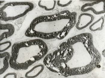  Nervenaxone