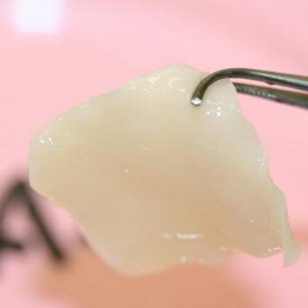  Knorpeltransplantat