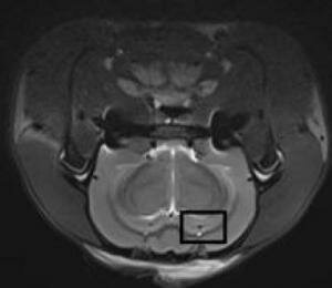  MRI- T2