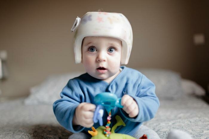  Baby trägt Korrektur Helm