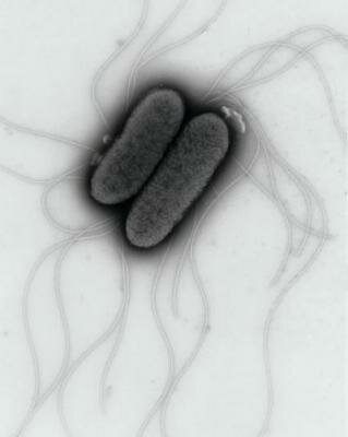  Salmonella Typhimurium