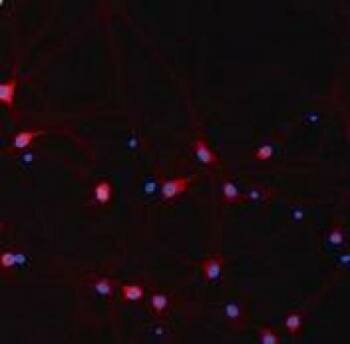  Neuronen im Hippocampus