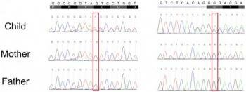  DNA-Sequenzierung Schizophrenie Gene