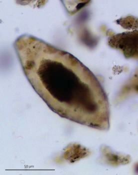  Schistosomiasis Ei