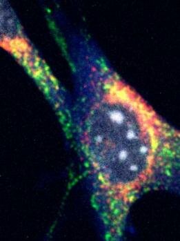  Mitophagy