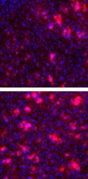  Potential Alzheimer- Medikament verhindert Abnormal Blutgerinnsel im Gehirn