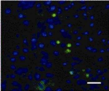  apoptotischer Zellen