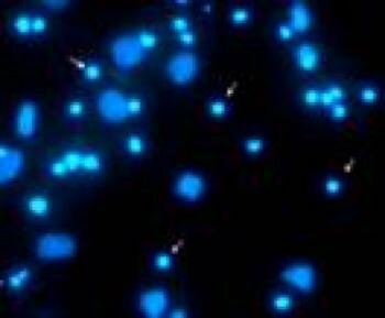 Neuronen im Hippocampus