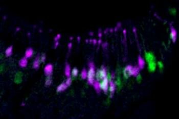  Vomeronasal Cells