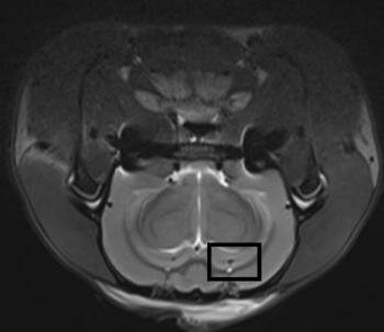  MRI- T2-gewichteten Bilder