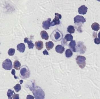  β -Thalassämie korrigierten Blood Cells