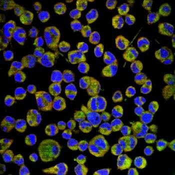  Strong Neuronal DHCR24 Expression