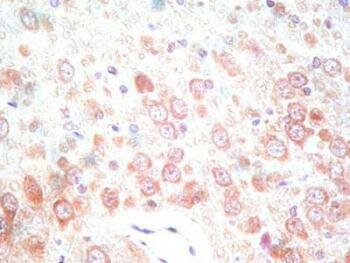  c-Jun N-terminale Kinase Ebene