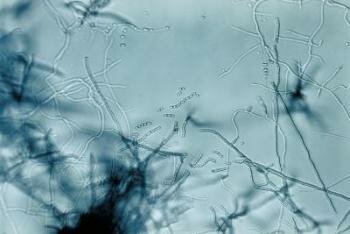  Streptomyces