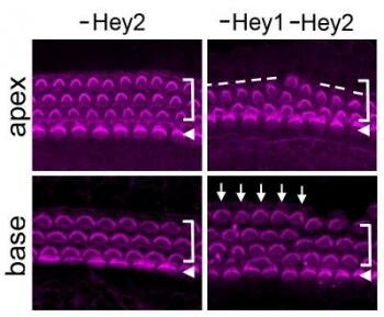  Mangel an Hey1 und Hey2 Verursacht Disorganized Haarzellen der Cochlea