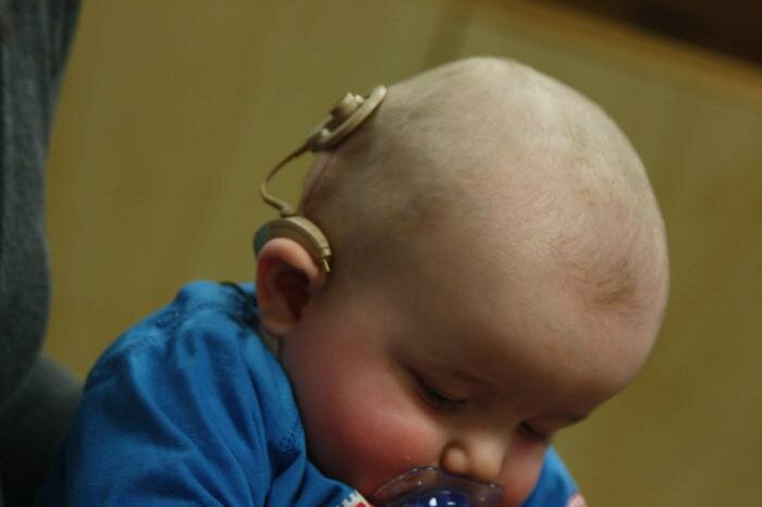  Kleinkind mit Cochlea-Implantat