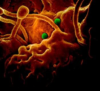  MERS Corona Partikel auf Camel Epithelzellen