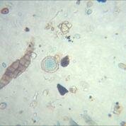  Mikroskopbilder von Ambrosia-Pollen