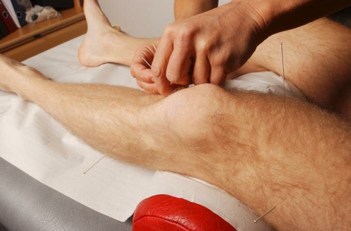  Patienten mit Akupunktur bis zum Knie