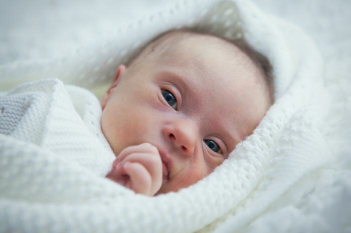  neugeborenen Babys mit Down-Syndrom