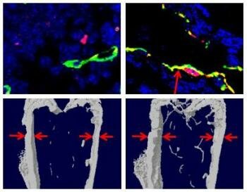  Die Drug L- 235 verbessert die Osteoporose bei Mäusen