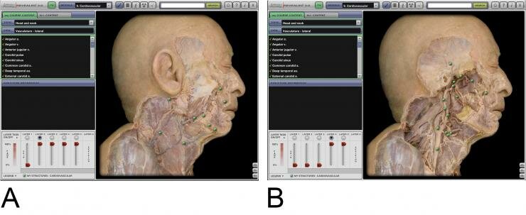 Computer simuliert Anatomie -Programm